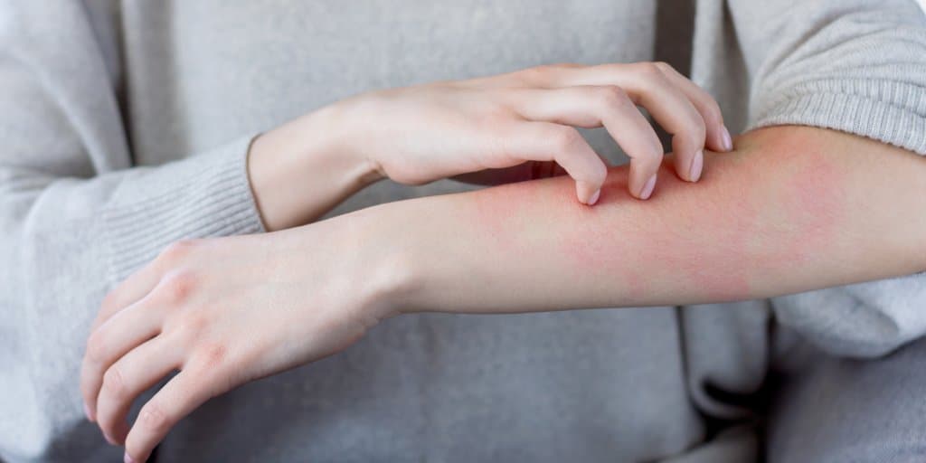 testy na nietolerancje pokarmowe